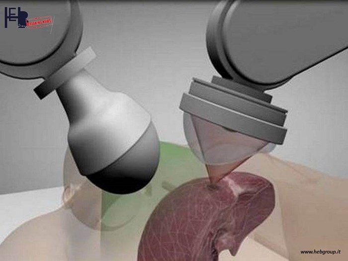 Futura, il robot chirurgo che attacca i tumori senza bisturi